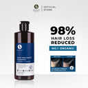 Hair Loss Treatment