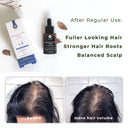 Eucalie Hair Growth / Anti Hair Fall Tonic Organic Serum – Strength & Volume