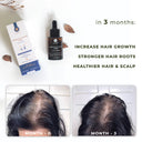 Hair Loss Treatment